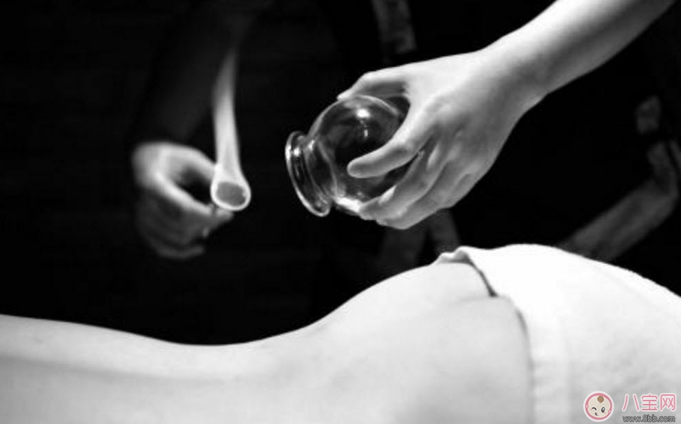 健康|孕妇拔火罐可以吗 孕妇肩膀能拔火罐吗(孕妇拔过火罐怎么办)