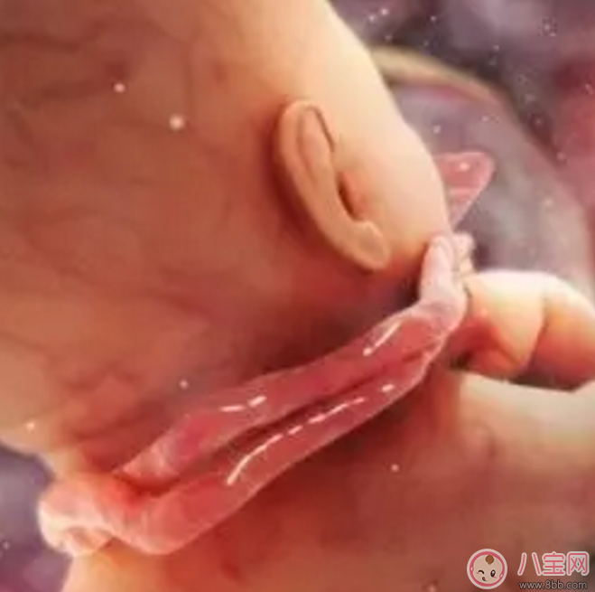 安全|胎儿脐带绕颈怎么办？产前怎样化解脐带绕颈？