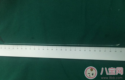 寄生虫|喝生水长寄生虫是真的吗 喝生水会有寄生虫吗