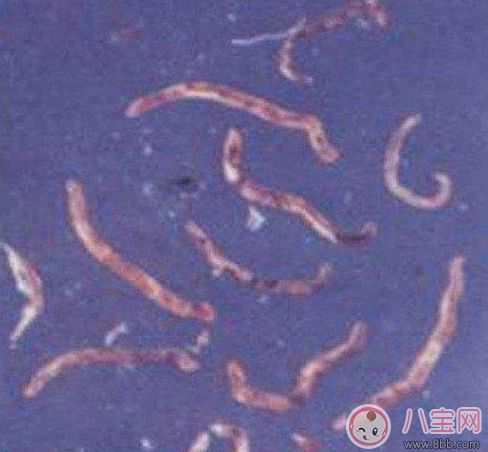 寄生虫|喝生水长寄生虫是真的吗 喝生水会有寄生虫吗