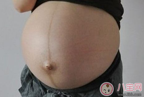 男女|怎么通过妊娠纹判断怀的是男是女妊娠纹判断性别方法