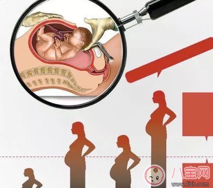 孕妇|剖腹产孕妇会不会感到疼痛 剖腹产横剖还是纵剖。
