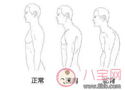 肩膀|1分钟帮你改善圆肩 孕后改善再美胸