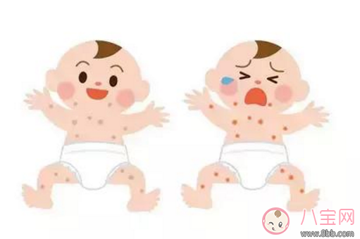 方法|宝宝长痱子怎么办 给宝宝去痱子的方法有哪些