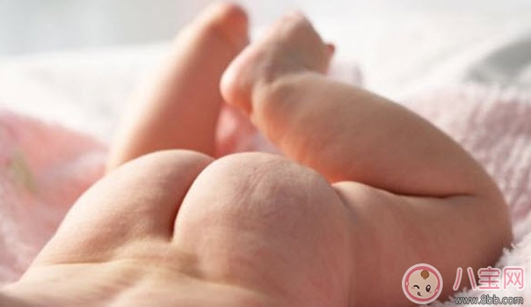 尿布|婴儿长尿布疹怎么办 尿布疹是怎么引起的