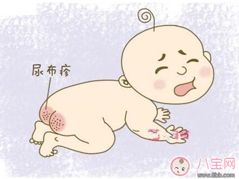 尿布|婴儿长尿布疹怎么办 尿布疹是怎么引起的