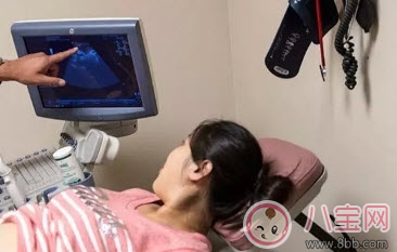 测试|林心如爱吃甜食生女孩怀孕如何测男女