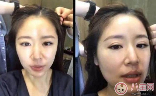 护肤|林心如孕后素颜拥有水光肌 孕后如何护肤