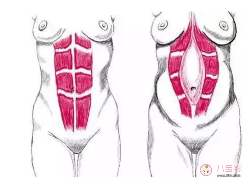 塑型|孕后如何在七夕拥有完美身材 孕后塑型这样做