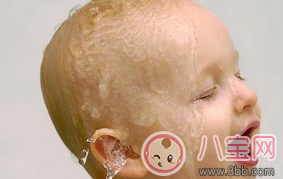 消化不良|2017三伏天宝宝消化不良引起睡眠性出汗如何调理