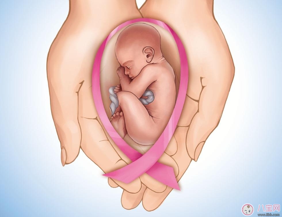 症状|乳腺癌早期的症状 孕后如何预防乳腺癌