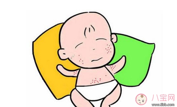 偏方|2017夏天孩子长痱子有什么偏方 去治痱子偏方有哪些