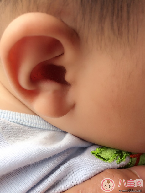 耳朵|宝宝耳朵脏了要洗吗 正确清洁耳朵方法