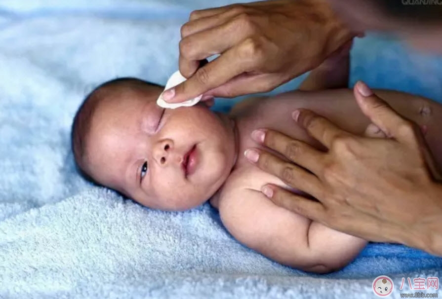 畸形|哪些孕妇易生畸形宝宝 做胎儿畸形的检查有哪些