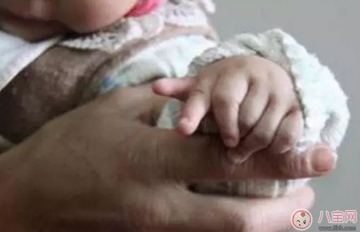 畸形|哪些孕妇易生畸形宝宝 做胎儿畸形的检查有哪些