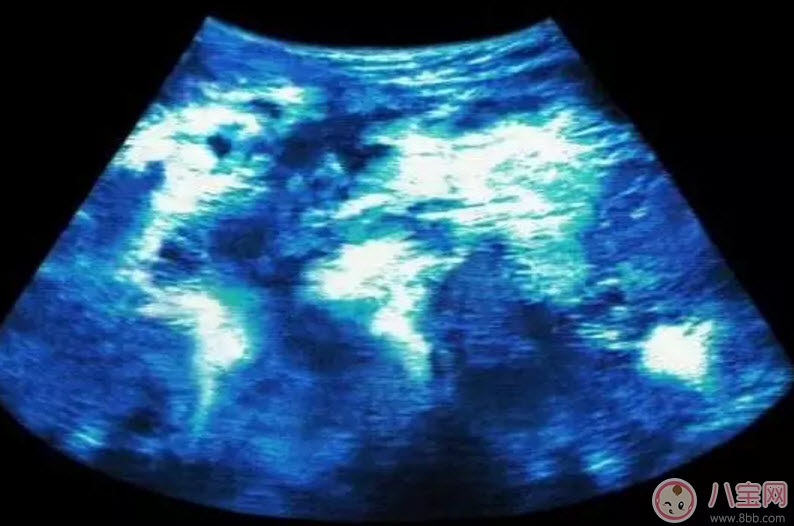 畸形|哪些孕妇易生畸形宝宝 做胎儿畸形的检查有哪些