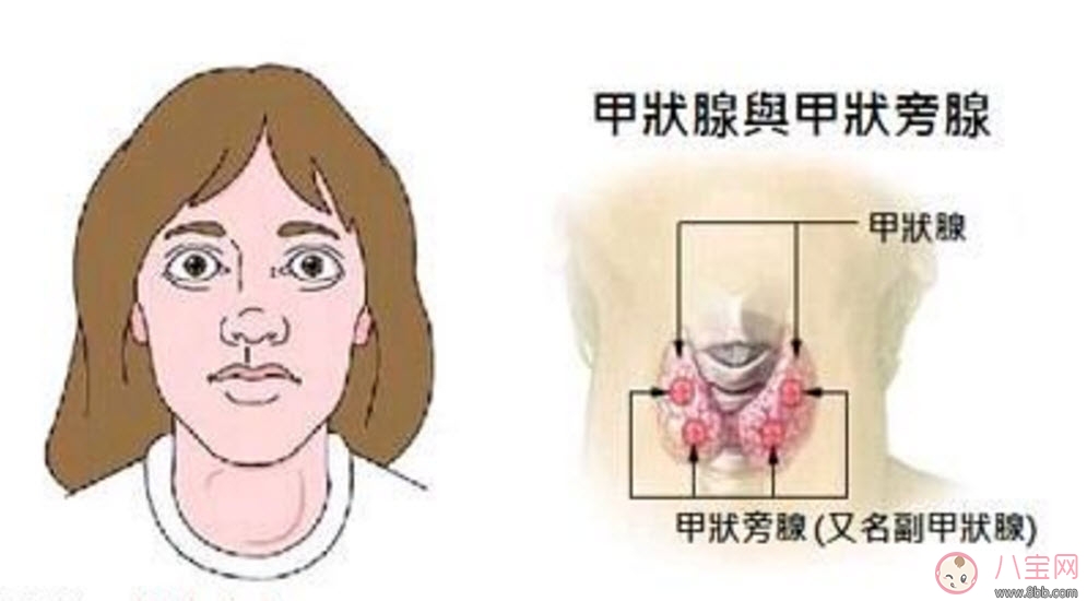 怀孕|甲亢能怀孕吗 甲亢怀孕对胎儿的影响