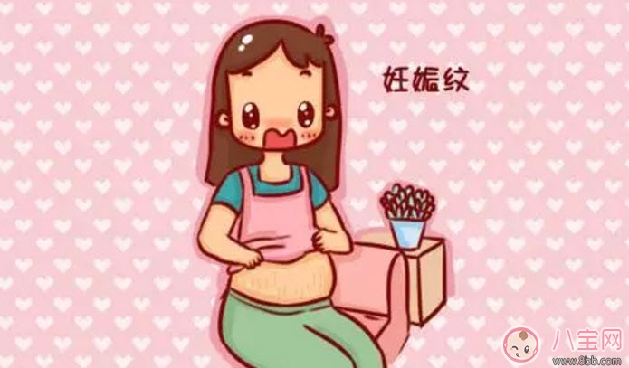 妊娠纹|孕晚期妊娠纹怎么控制 孕晚期妊娠纹怎么缓解