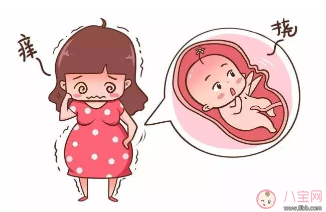 肚皮痒|孕晚期肚皮痒怎么办 孕晚期肚皮痒怎么缓解