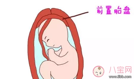 见红|什么是孕晚期见红 孕晚期见红肚子疼怎么办