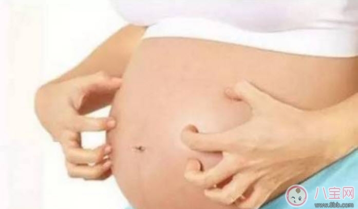 皮肤|孕妇皮肤痒怎么办 孕妇身体痒怎么缓解