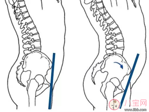 李菲儿|柯基臀是骨盆前倾吗 李菲儿的柯基臀是怎么练成的
