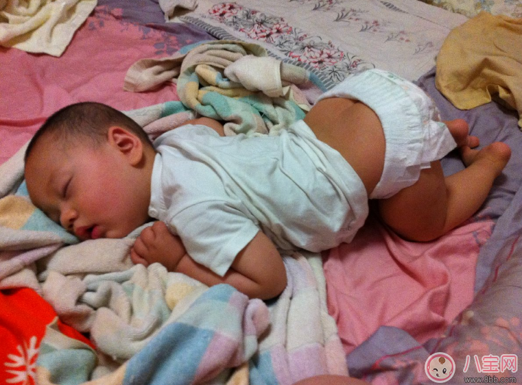 痱子|宝宝痱子总不消 用用这个准会好