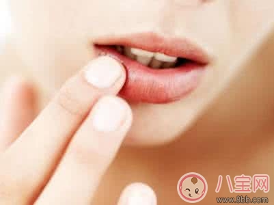 上火|夏季孕妇上火嘴唇起泡的原因 如何治疗