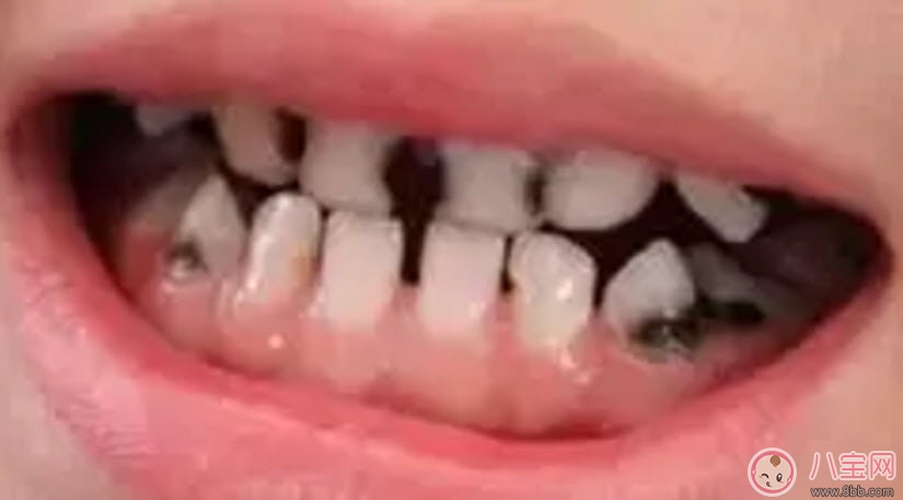 刷牙|宝宝一直不爱刷牙 找对方法很关键