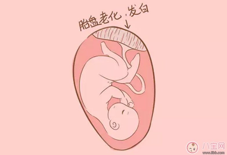 胎盘|孕晚期胎盘老化能顺产吗 胎盘三级必须剖腹产吗