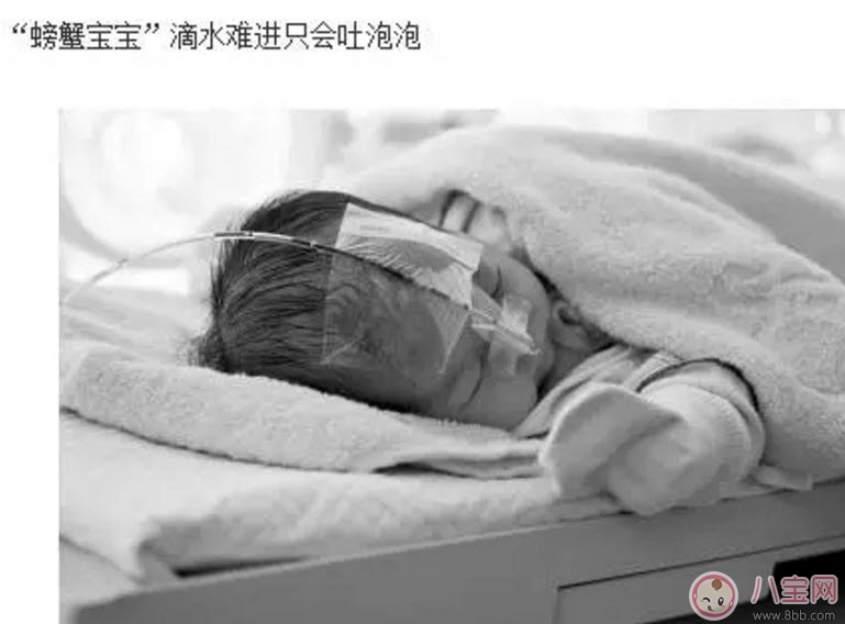 吐泡泡|宝宝吐泡泡就是肺炎吗 宝宝吐泡泡是怎么回事