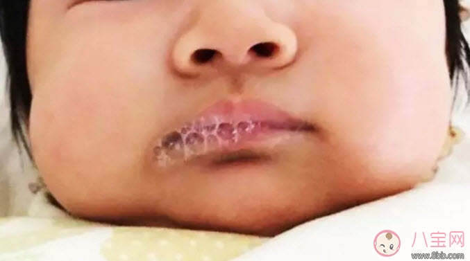 吐泡泡|宝宝吐泡泡就是肺炎吗 宝宝吐泡泡是怎么回事