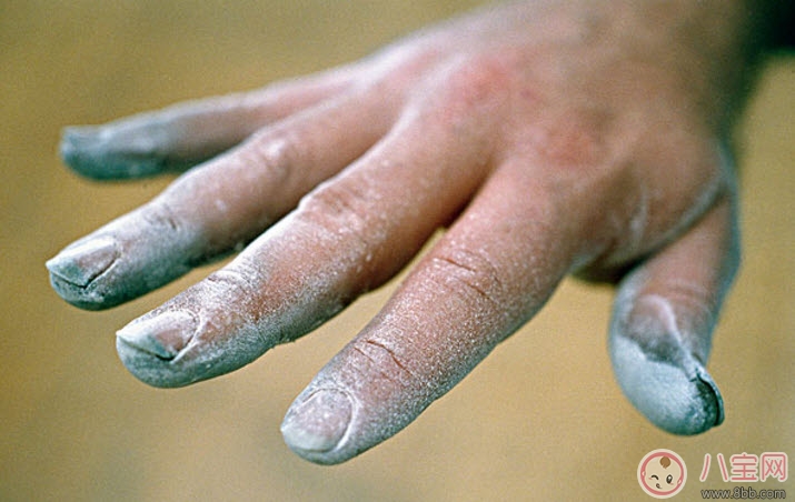 灰指甲|孕妇得了灰指甲怎么办 孕妇的灰指甲会影响胎儿吗