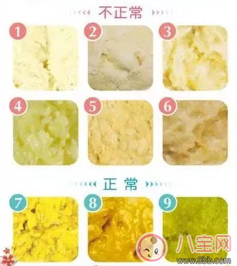 排便|宝宝大便显示了宝宝的状况 注意宝宝排便频率