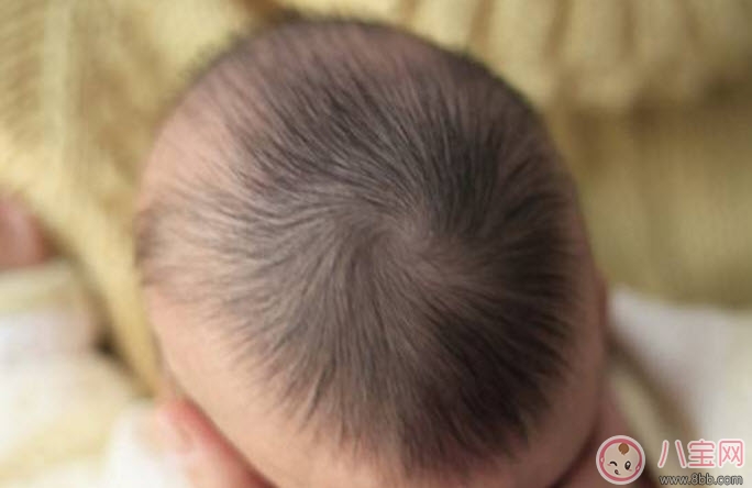 虚汗|夏天宝宝出汗多是什么原因 宝宝出汗和虚汗的区别