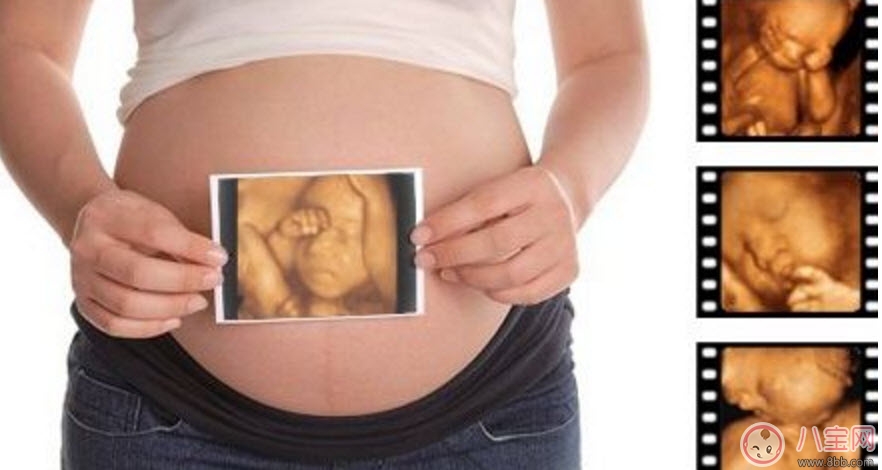 B超|孕妇四维彩超的最佳时间 孕妇一定要做四维彩超吗