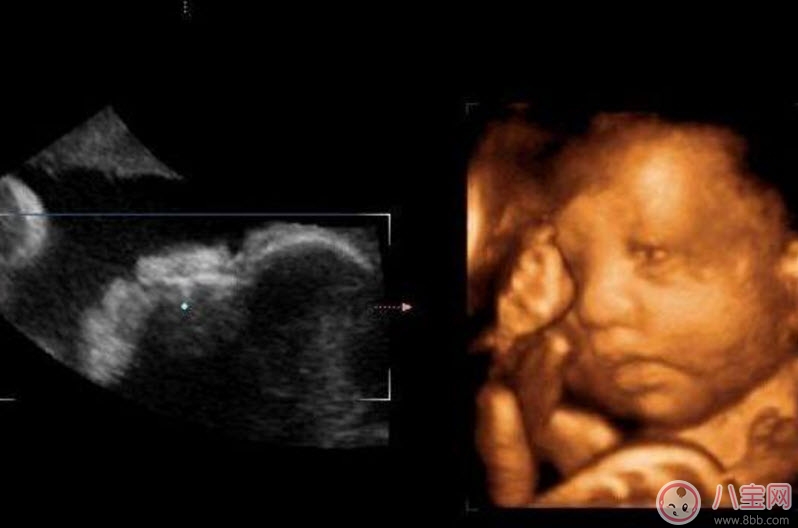 B超|孕妇四维彩超的最佳时间 孕妇一定要做四维彩超吗