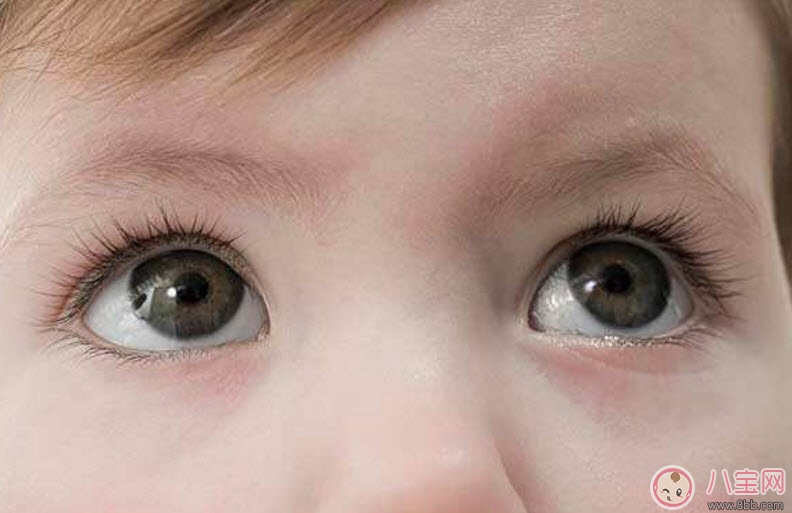 眼药水|哪些情况要给宝宝用眼药水 宝宝眼药水怎么滴