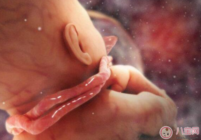 脐带绕颈|脐带绕颈怎么办 婴儿脐带绕颈严重吗