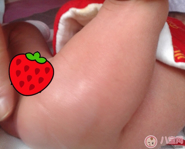 护臀膏|贝亲护臀膏可以擦脸吗 贝亲婴儿护臀膏能天天用吗
