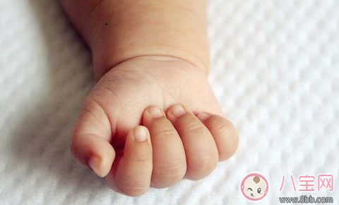 倒刺|孩子手上长倒刺 宝妈应该这么做