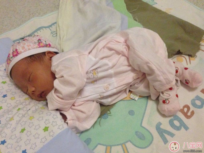 扁头|宝贝头型太扁了可以矫正吗 宝宝头型睡回来方法