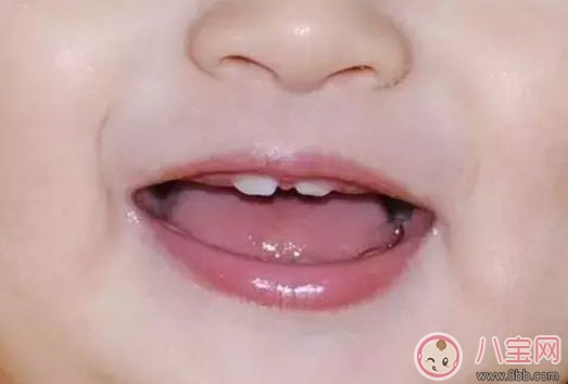 牙缝|宝宝牙缝宽是什么原因 宝宝牙缝宽会自己闭拢吗