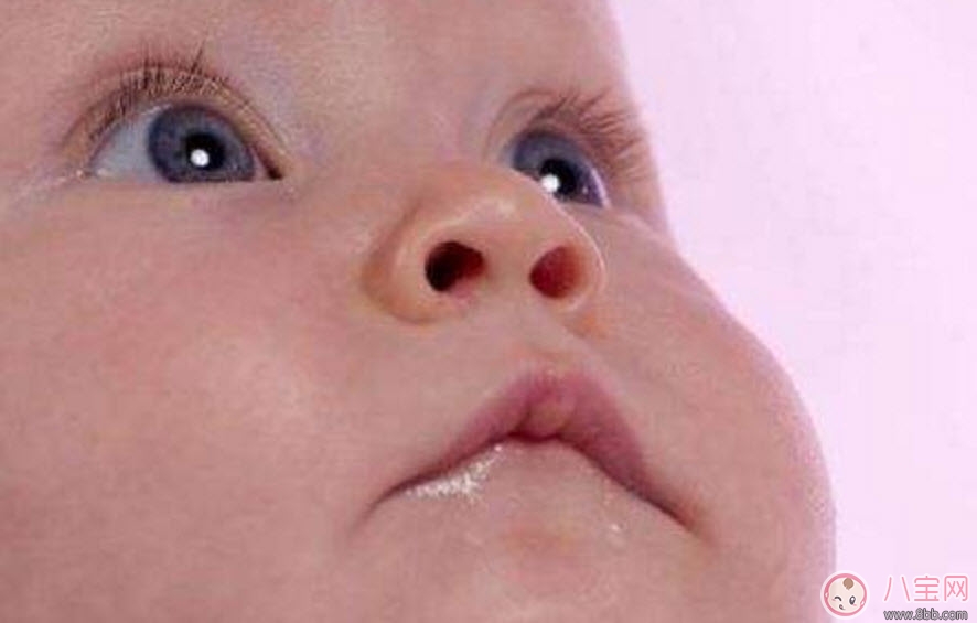 手术|宝宝斜视手术风险大吗 宝宝斜视一定要做手术吗