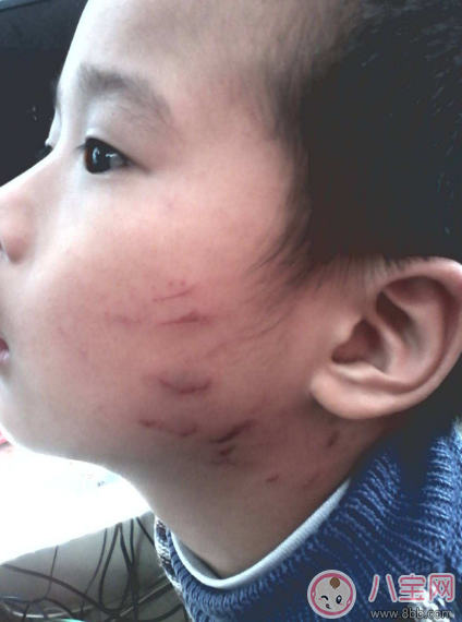 抓人|孩子经常性的抓人怎么办 孩子抓人多半是因为家庭