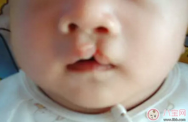 食物|孕妇能吃兔肉吗 孕妇吃兔肉对宝宝有什么好处