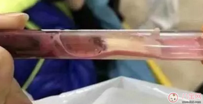 饮食|1岁男童吃西兰花中毒 西兰花烧制禁忌