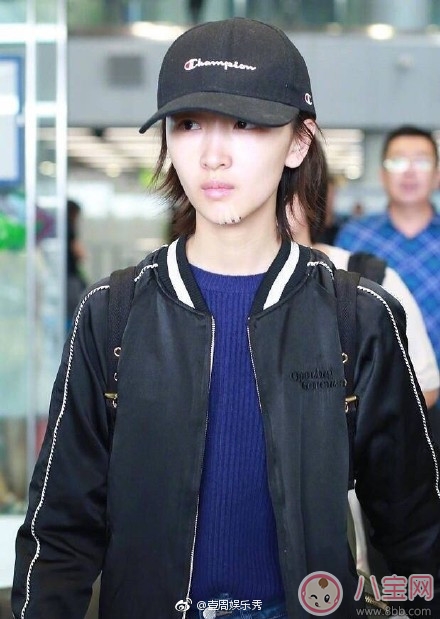 受伤|周冬雨下巴为什么会出现疤痕 周冬雨下巴受伤的原因