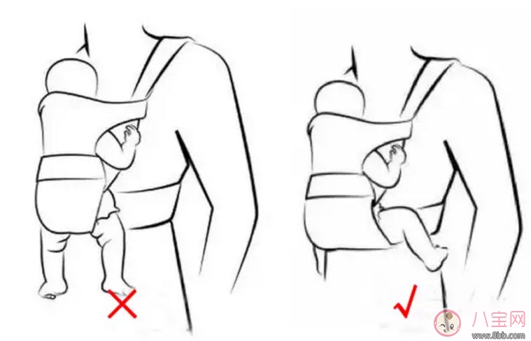 腿|婴儿为什么是青蛙腿 宝宝青蛙腿用不用绑腿