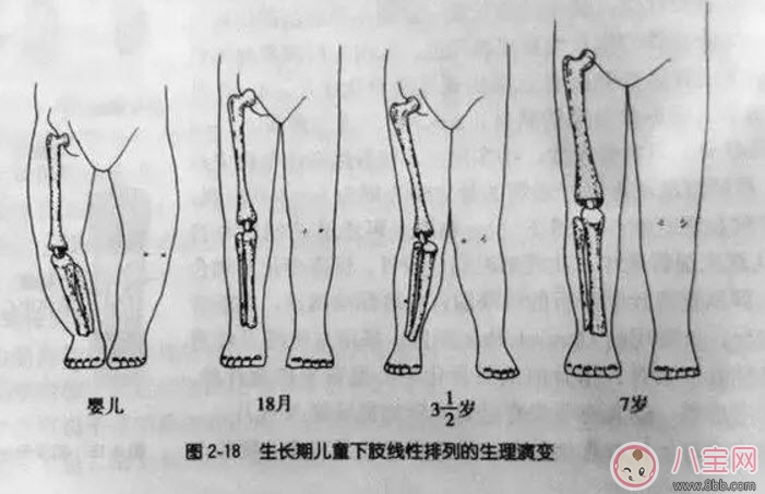 腿|婴儿为什么是青蛙腿 宝宝青蛙腿用不用绑腿